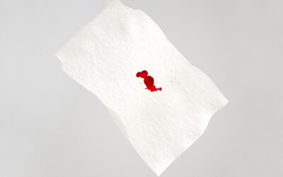 7 ok, amiért vért láthatsz a bugyidon, ha épp nem menstruálsz