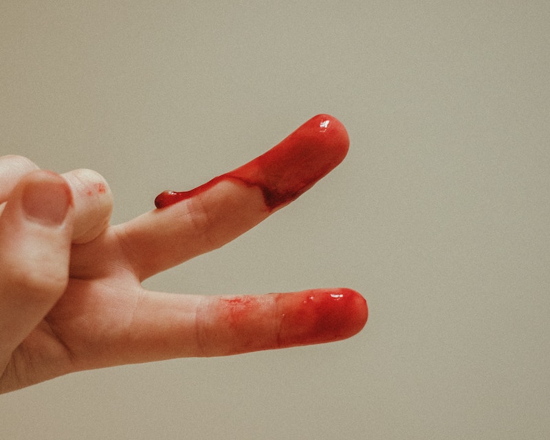 Rettegsz a menstruációs vértől? Esetleg kontrollálhatatlanul tartasz magától a menstruációtól? Lehet, hogy menofóbiával van dolgod.